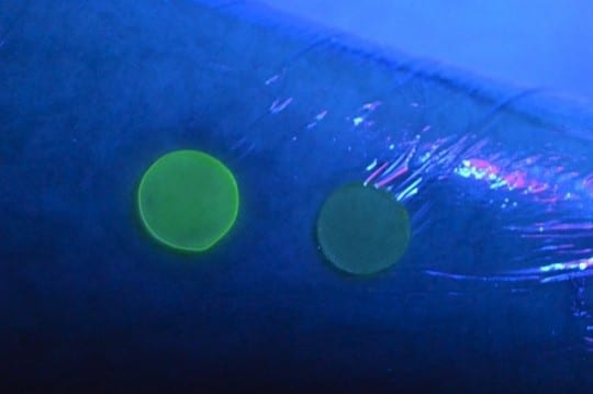 MedicalDressingBrandwond