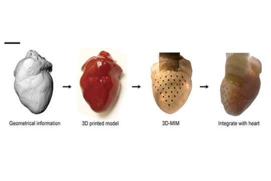 3D-printed-pacemaker-membrane
