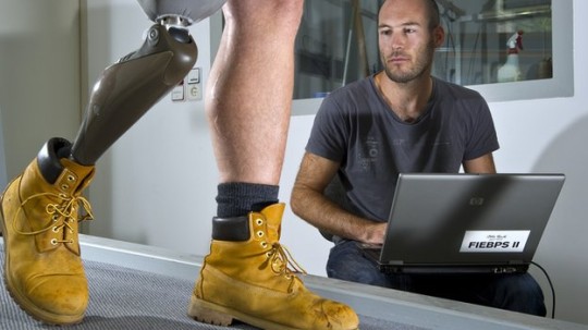 _74233456_prosthetic